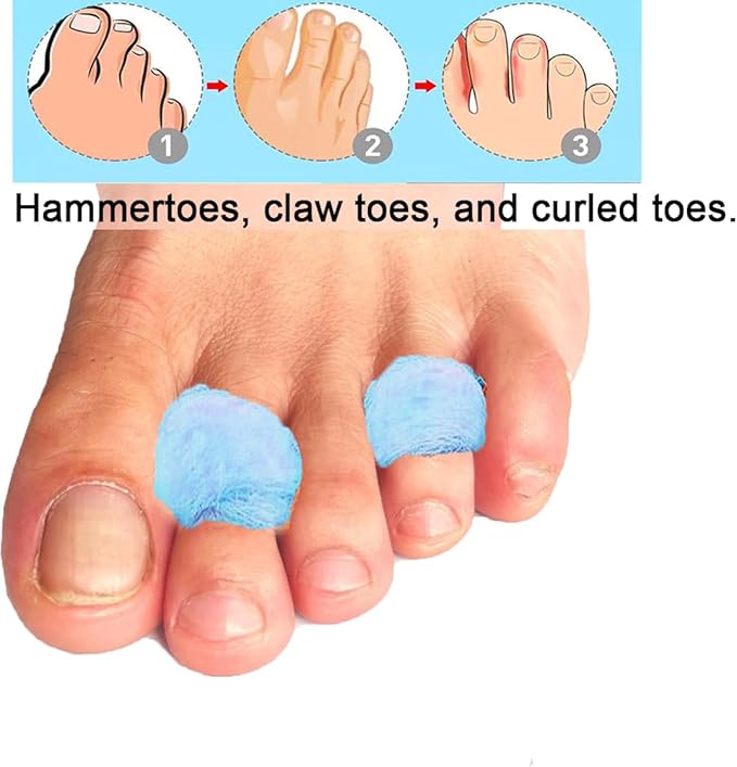 2 Pack Lambs Wool Toe Splint