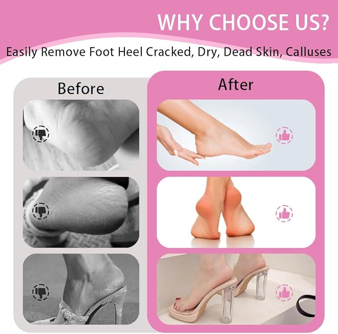 1pc Professional Electric Foot File 60 Pcs