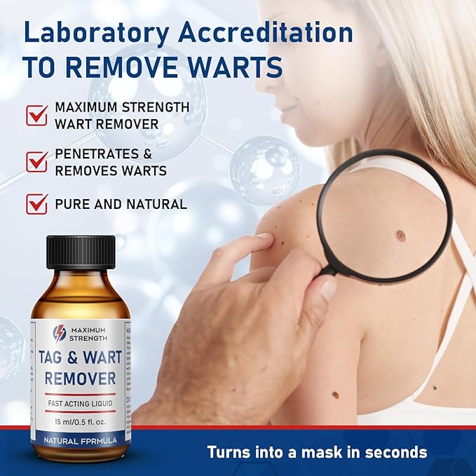 15ML Skin Tag Removal Kit, at-home Callus-1112-A6