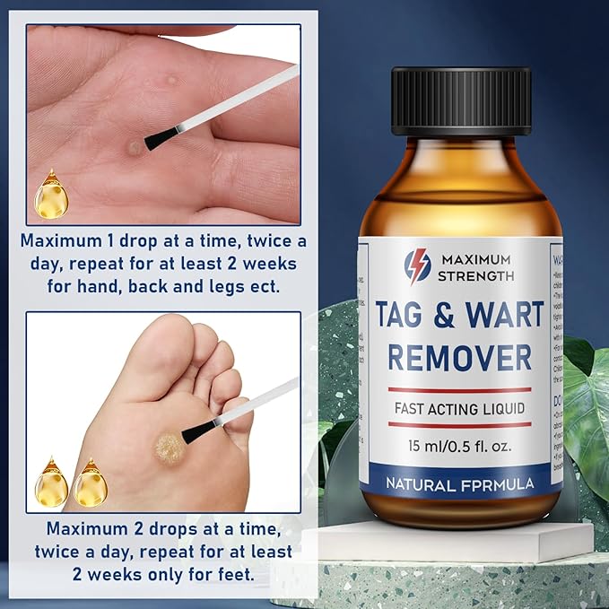 15ML Skin Tag Removal Kit, at-home Callus-1112-A6