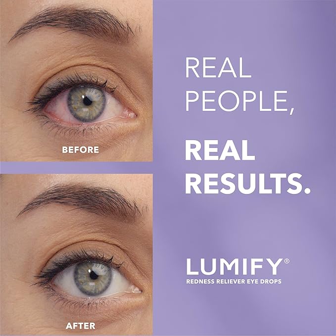 LUMIFY Redness Reliever Eye Drops, 0.08 Fl (2.5 mL)