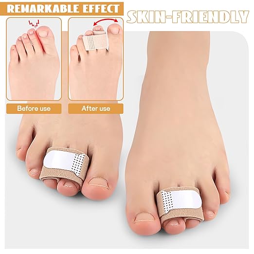 15Pcs Fabric Hammer Toe Corrector (15)